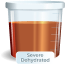 Severe Dehydrated
