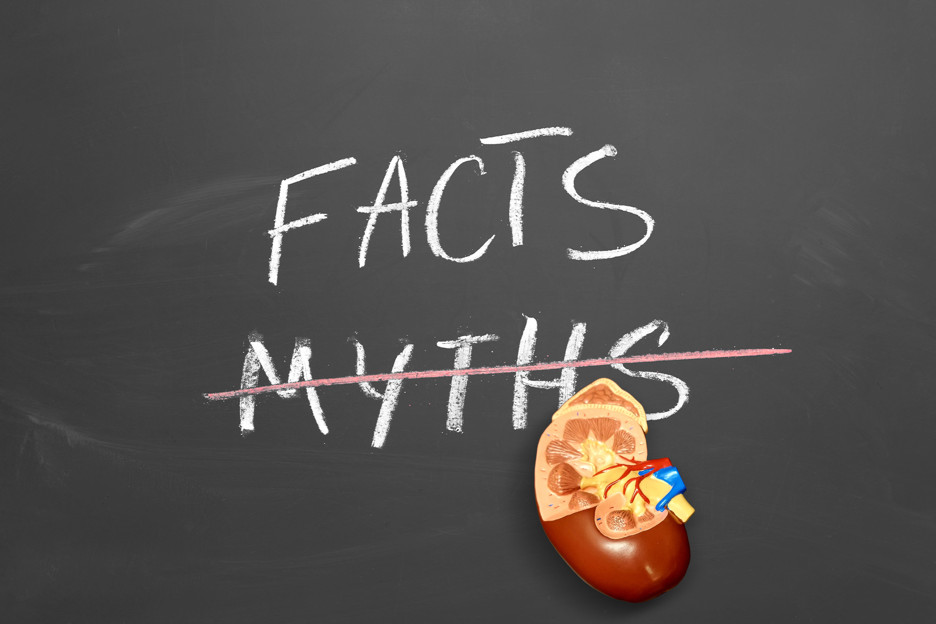 Cara Meluruhkan Batu Ginjal Tanpa Operasi, Mitos atau Fakta?